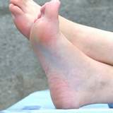 female athletes feet