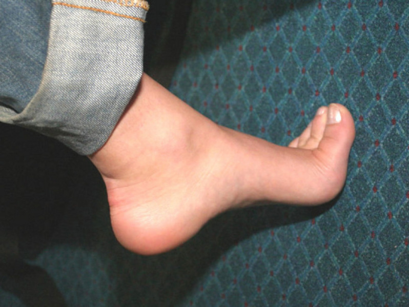 Crushed giantess foot
