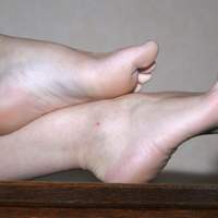 feet and leg swelling